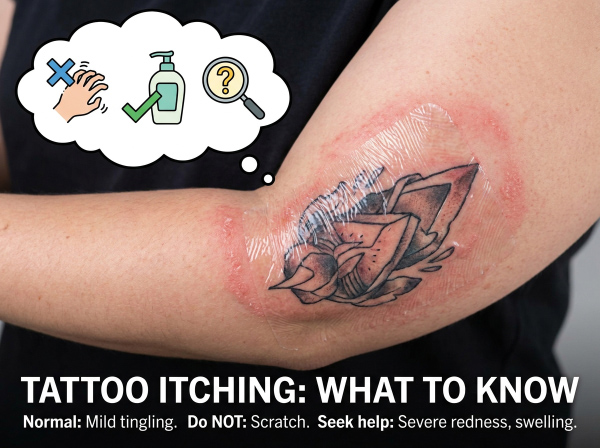 Tattoo Itching: What Is Normal and What Is Not